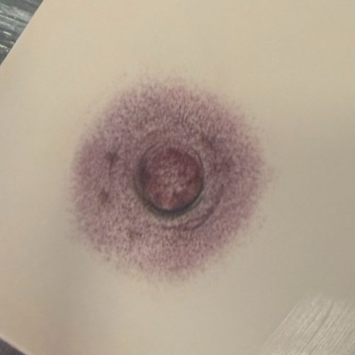 Brustwarzenrekonstruktion Medizinische Pigmentierung / Brustwarzenrekonstruktion auf Kunsthaut